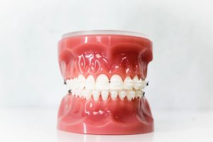 Elements Of The Orthodontic Treatment